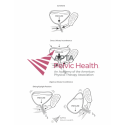 Bladder Incontinence