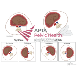 Hypotensive Syndrome