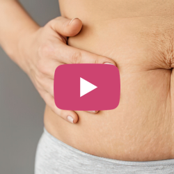 Holding the Line - Does Anything Actually Work to Heal DRA?